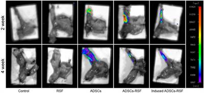 Local injection of adipose-derived mesenchymal stem cells in silk fibroin solution on the regeneration of lower esophageal sphincter in an animal model of GERD